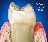 Understanding Gum Disease... Is It Affecting YOU?