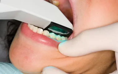 Digital impression technology used by Dr. Colon